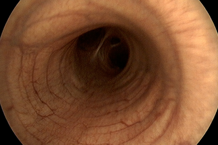 Visuel gamme endoscopie