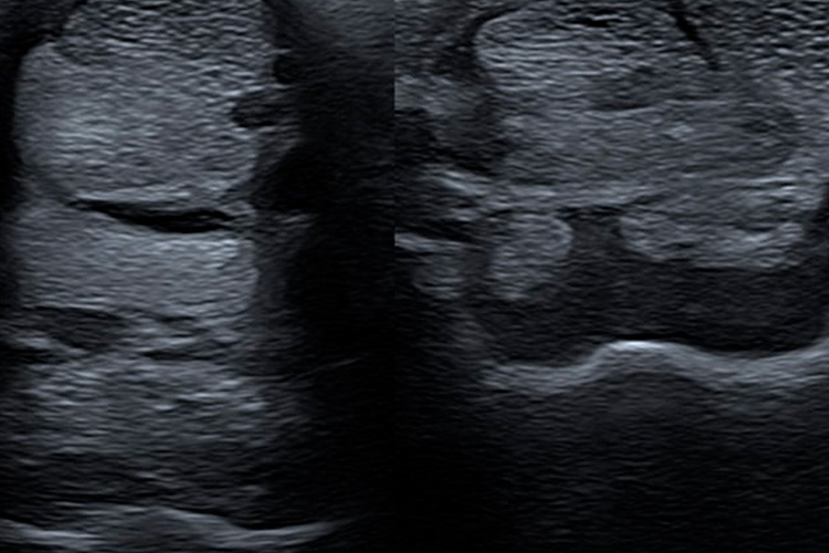 Visuel gamme ultrason